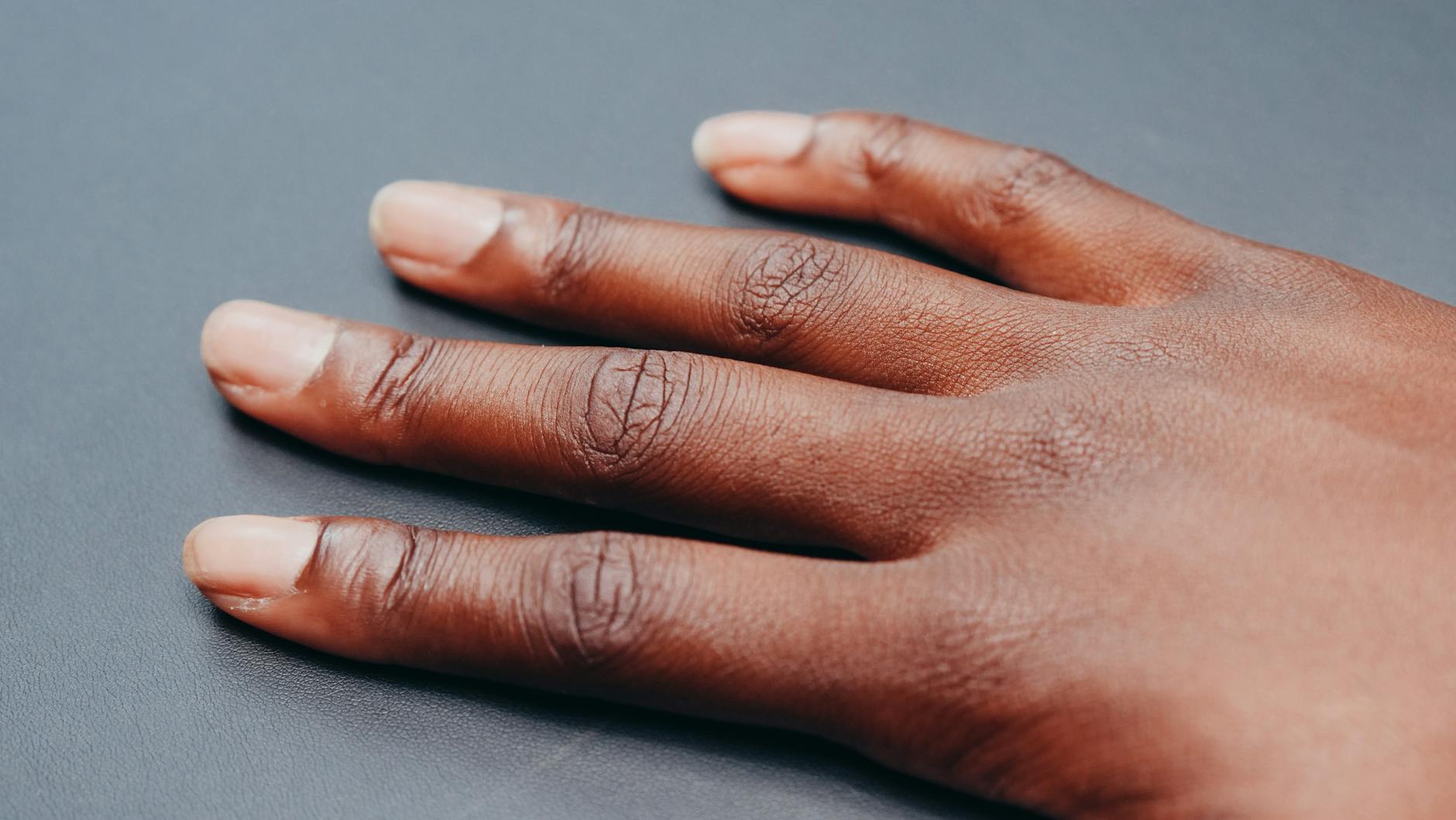 Zbliżenie dłoni z palcami na neutralnym tle, widoczna lekka opuchlizna